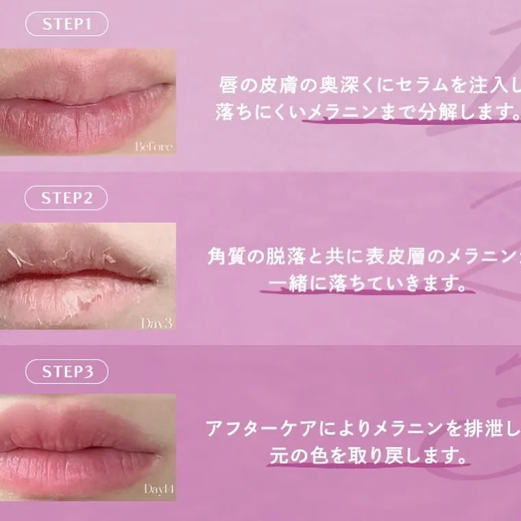 【蒲田で魅力的な唇へ】