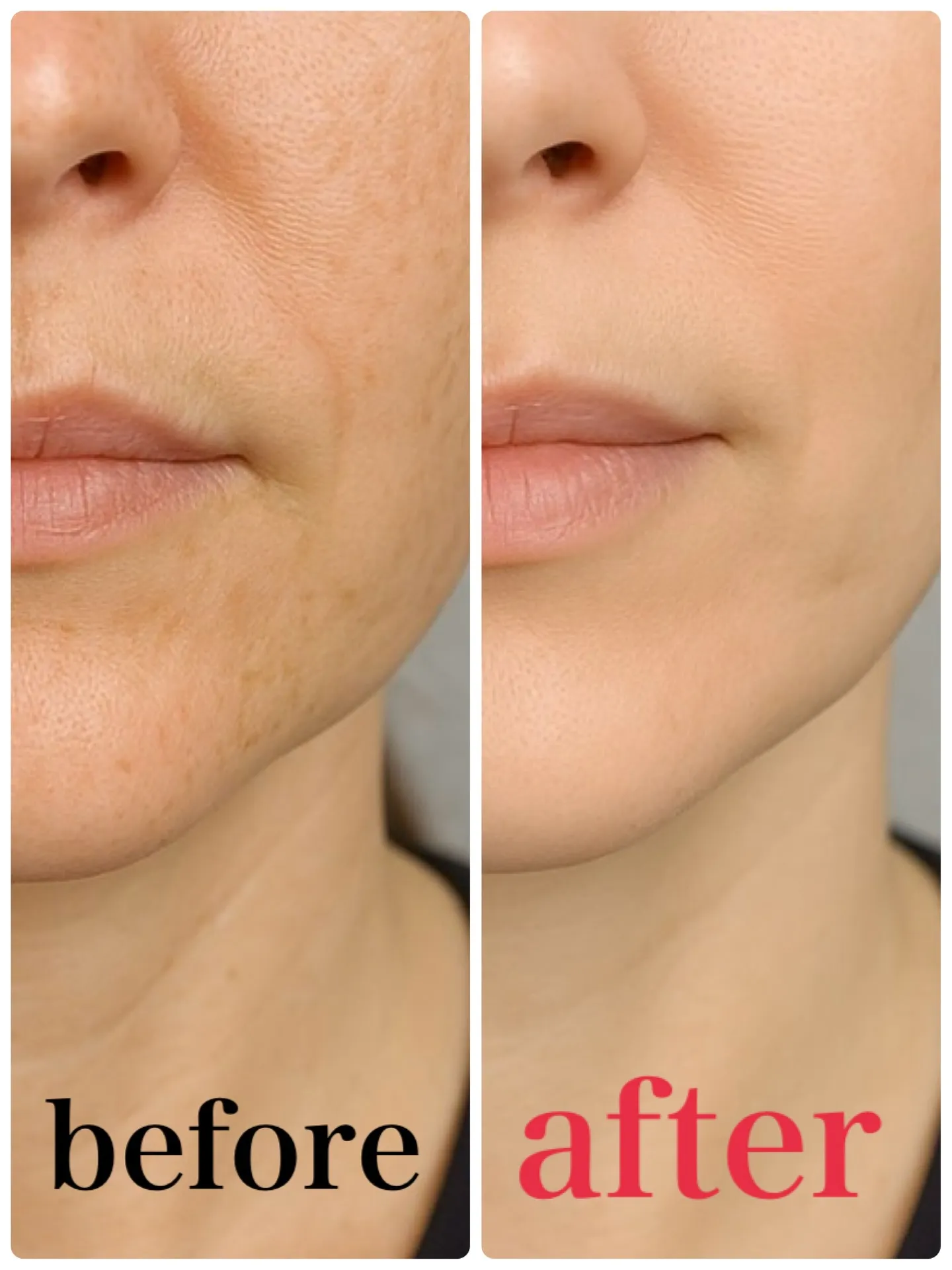 【蒲田でくすみケア❣️透明感あふれる素肌へ⤴️】