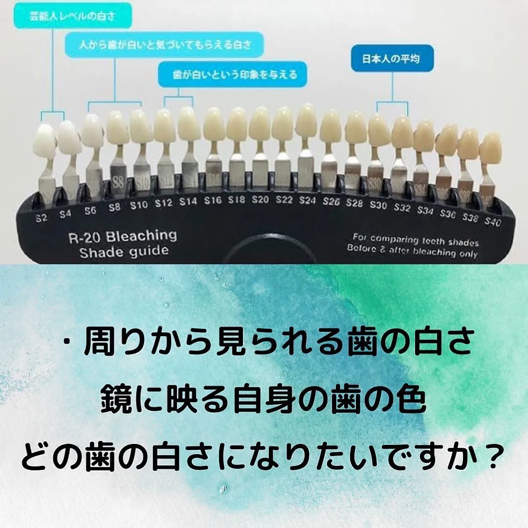 【大森／年齢問わず🦷ホワイトニングで歯は白くなる？】